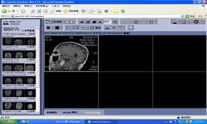 PACS醫學影像傳輸系統